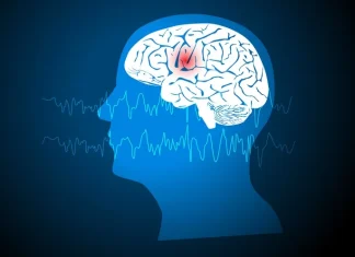 Zorevunersen Results in Dravet Syndrome