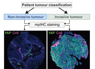 Playing music to cells reduces laryngeal cancer aggressiveness in lab tests