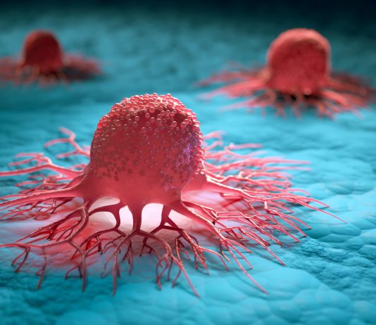 AYA Cancer Survivors and Risk for Earlier Subsequent Primary Neoplasms