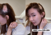 Controversial influencer Rachel Chung reveals severe hair loss, opens up about alopecia