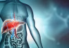 Liver Health: Liver disease myths debunked: Early detection and lifestyle changes crucial for reversal