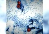 Cyclosporiasis cases rise again. Latest update for Illinois – NBC Chicago