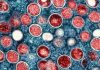 Health officials track Arizona’s first travel-associated case of Clade I mpox