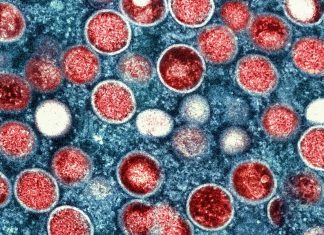 Health officials track Arizona’s first travel-associated case of Clade I mpox