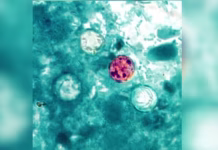 What’s going around? Cyclosporiasis cases in Virginia remain low as U.S. numbers continue to rise