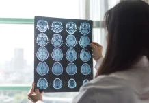 Researchers Uncover New Lifestyle Factor That Could Affect Alzheimer’s Risk