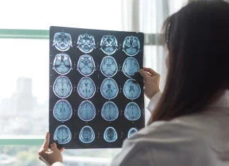 Researchers Uncover New Lifestyle Factor That Could Affect Alzheimer’s Risk