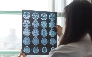 Researchers Uncover New Lifestyle Factor That Could Affect Alzheimer’s Risk